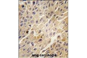 Immunohistochemistry (Paraffin-embedded Sections) (IHC (p)) image for anti-Adrenergic, Beta, Receptor Kinase 1 (ADRBK1) (AA 633-660), (C-Term) antibody (ABIN1882061)