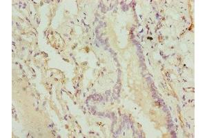 Immunohistochemistry of paraffin-embedded human lung tissue using ABIN7148645 at dilution of 1:100 (CMC1 抗体  (AA 1-106))