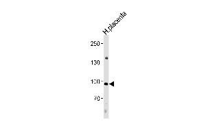 Western Blotting (WB) image for anti-Nuclear Factor of Activated T-Cells, Cytoplasmic, Calcineurin-Dependent 4 (NFATC4) (AA 744-773), (C-Term) antibody (ABIN657086)
