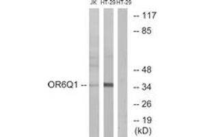 Western blot analysis of extracts from Jurkat/HT-29 cells, using OR6Q1 Antibody. (OR6Q1 抗体  (AA 23-72))
