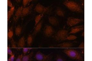 Immunofluorescence analysis of C6 cells using GCAT Polyclonal Antibody at dilution of 1:100. (GCAT 抗体)