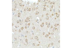 Immunohistochemistry of paraffin-embedded mouse brain using RHOT2 Rabbit pAb (ABIN3016307, ABIN3016308, ABIN1682532 and ABIN6219710) at dilution of 1:50 (40x lens). (RHOT2 抗体  (AA 280-480))