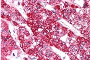 Human Adrenal (formalin-fixed, paraffin-embedded) stained with EIF4G2 antibody ABIN214749 at 5 ug/ml followed by biotinylated goat anti-rabbit IgG secondary antibody ABIN481713, alkaline phosphatase-streptavidin and chromogen. (EIF4G2 抗体  (AA 766-815))