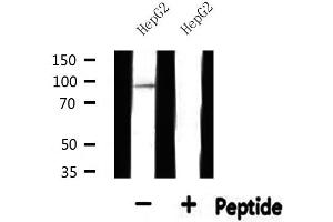 Western blot analysis of extracts from HepG2, using SOX6 Antibody. (SOX6 抗体  (N-Term))