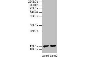 Western blot All lanes: mpt63 antibody at 2 μg/mL Lane 1: Recombinant Mycobacterium tuberculosis Immunogenic protein MPT63 protein 1 μg Lane 2: Recombinant Mycobacterium tuberculosis Immunogenic protein MPT63 protein 0. (MPT63 抗体  (AA 30-159))