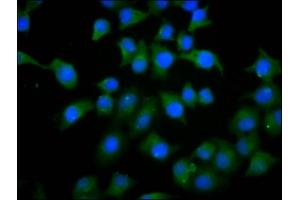 Immunofluorescence staining of A549 cells with ABIN7163100 at 1:133, counter-stained with DAPI. (PHACTR1 抗体  (AA 263-387))