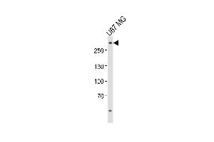 Western Blotting (WB) image for anti-ATP-Binding Cassette, Sub-Family A (ABC1), Member 2 (ABCA2) (AA 1339-1373) antibody (ABIN6243013)