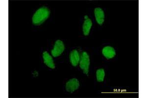 Immunofluorescence of purified MaxPab antibody to DMAP1 on HeLa cell. (DMAP1 抗体  (AA 1-467))