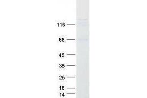 USP37 Protein (Myc-DYKDDDDK Tag)