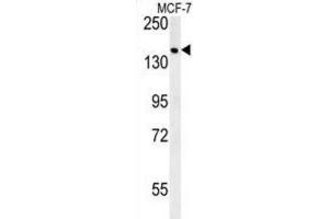 Western Blotting (WB) image for anti-Sterile alpha Motif Domain Containing 9 (SAMD9) antibody (ABIN3002418) (SAMD9 抗体)