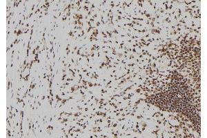 ABIN6273826 at 1/100 staining Human gastric tissue by IHC-P. (Becn2 (N-Term) 抗体)