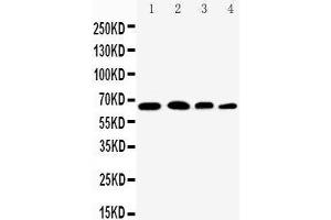 Anti-NF-kB p65 antibody, Western blotting Lane 1: Rat Testis Tissue Lysate Lane 2: HELA Cell Lysate Lane 3: A431 Cell Lysate Lane 4: JURKAT Cell Lysate (NF-kB p65 抗体  (Middle Region))