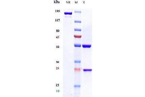 Anti-CD20 Reference Antibody (rituximab) on SDS-PAGE under reducing (R) condition. (Recombinant MS4A1 (Rituximab Biosimilar) 抗体)