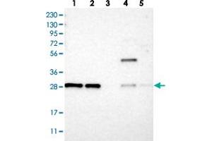 Western blot analysis of Lane 1: RT-4, Lane 2: U-251 MG, Lane 3: Human Plasma, Lane 4: Liver, Lane 5: Tonsil with TMEM234 polyclonal antibody  at 1:250-1:500 dilution. (TMEM234 抗体)