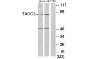 Western Blotting (WB) image for anti-Transforming, Acidic Coiled-Coil Containing Protein 3 (TACC3) (AA 789-838) antibody (ABIN2890716) (TACC3 抗体  (AA 789-838))