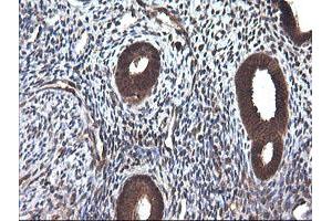 Image no. 1 for anti-Cancer/testis Antigen 1B (CTAG1B) antibody (ABIN1499906) (CTAG1B 抗体)