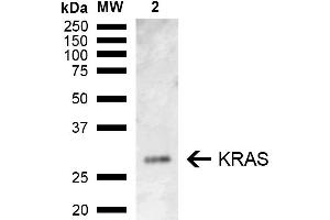 Western blot analysis of Rat Kidney showing detection of ~21. (K-RAS 抗体  (AA 100-189) (FITC))
