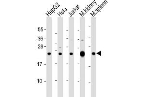 All lanes : Anti-NDUFB9 Antibody (Center) at 1:2000 dilution Lane 1: HepG2 whole cell lysate Lane 2: Hela whole cell lysate Lane 3: Jurkat whole cell lysate Lane 4: mouse kidney lysate Lane 5: mouse spleen lysate Lysates/proteins at 20 μg per lane.