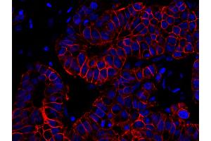 Immunofluorescence (IF) image for anti-Receptor tyrosine-protein kinase erbB-2 (ErbB2/Her2) (C-Term) antibody (ABIN7448962)