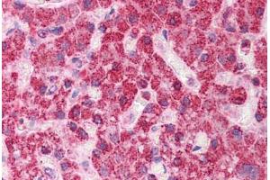 Human Liver: Formalin-Fixed, Paraffin-Embedded (FFPE) (TST 抗体  (AA 101-150))