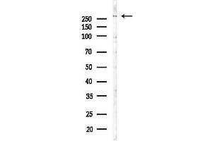 Western blot analysis of lysates from COLO205 cells(UV 30 min treatment), using DNAH7 Antibody at 1/1000 dilution. (DNAH7 抗体)