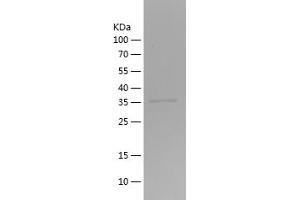 Western Blotting (WB) image for Solute Carrier Family 2 (Facilitated Glucose Transporter), Member 1 (SLC2A1) (AA 210-280) protein (His-IF2DI Tag) (ABIN7281991) (GLUT1 Protein (AA 210-280) (His-IF2DI Tag))