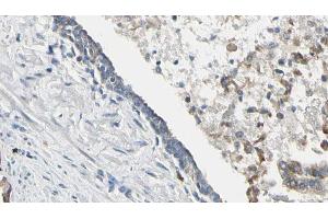 ABIN6268658 at 1/100 staining Human prostate tissue by IHC-P. (PIK3CA 抗体  (Internal Region))