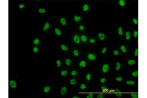 Immunofluorescence of monoclonal antibody to ARID1B on HeLa cell. (ARID1B 抗体  (AA 1364-1460))