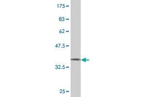 Western Blot detection against Immunogen (37. (Spastin 抗体  (AA 200-304))