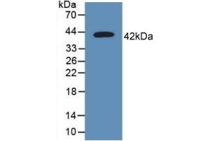 Detection of Recombinant CD63, Human using Polyclonal Antibody to Tetraspanin 30Cluster of Differentiation 63 (CD63) (CD63 抗体  (AA 103-203))