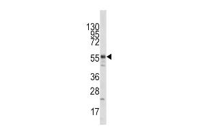 Western blot analysis of anti-HTATIP Pab (ABIN387933 and ABIN2844453) in mouse liver tissue lysate (35 μg/lane). (KAT5 抗体  (N-Term))
