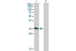 Western Blot analysis of TSSK3 expression in transfected 293T cell line by TSSK3 monoclonal antibody (M07), clone 6B2. (TSSK3 抗体  (AA 1-268))