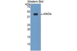Western blot analysis of the recombinant protein. (Cardiac Troponin T2 抗体  (AA 2-100))