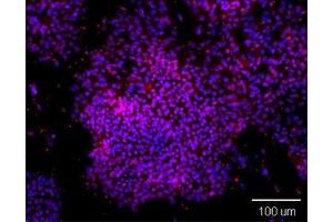 Immunofluorescence (IF) image for anti-POU Class 5 Homeobox 1 (POU5F1) antibody (ABIN615524)