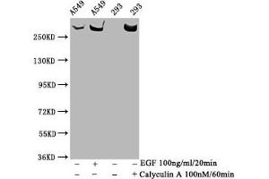 Western Blot Positive WB detected in A549 whole cell lysate,293 whole cell lysate(treated with Calyculin A or EGF) All lanes Phospho-MTOR antibody at 1. (Recombinant MTOR 抗体  (pSer2481))