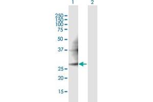 Western Blot analysis of PMM2 expression in transfected 293T cell line ( H00005373-T01 ) by PMM2 MaxPab polyclonal antibody. (PMM2 抗体  (AA 1-246))