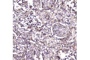 Immunohistochemistry (IHC) image for anti-S100 Calcium Binding Protein A10 (S100A10) (AA 4-94) antibody (ABIN5692833)