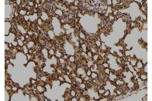 ABIN6273575 at 1/100 staining Mouse lung tissue by IHC-P. (ZNF768 抗体  (Internal Region))