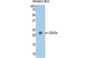 Detection of Recombinant PAPPA2, Human using Polyclonal Antibody to Pappalysin 2 (PAPPA2) (PAPPA2 抗体  (AA 1309-1492))