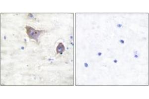 Immunohistochemistry analysis of paraffin-embedded human brain tissue, using Synuclein beta Antibody. (beta Synuclein 抗体  (AA 85-134))