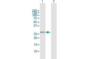 Western Blot analysis of RAB23 expression in transfected 293T cell line by RAB23 MaxPab polyclonal antibody. (RAB23 抗体  (AA 1-237))