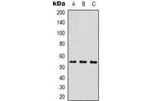 Western blot analysis of MICU1 expression in MCF7 (A), mouse brain (B), rat brain (C) whole cell lysates. (MICU1 抗体)