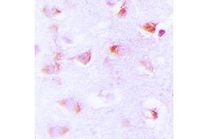 Immunohistochemical analysis of ACC alpha (pS80) staining in human brain formalin fixed paraffin embedded tissue section. (Acetyl-CoA Carboxylase alpha 抗体  (N-Term, pSer80))