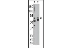 The anti-MTM1 C-term Pab is used in Western blot to detect MTM1 in NCI-H460 cell lysate (lane 1) and in mouse heart tissue lysate (lane 2). (MTM1 抗体  (C-Term))