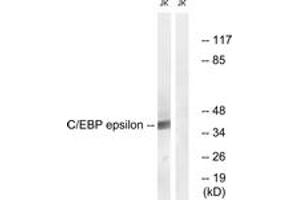 Western blot analysis of extracts from JurKat cells, treated with Insulin 0. (CEBPE 抗体  (AA 40-89))