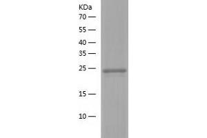 RAB24 Protein (AA 1-227) (His tag)