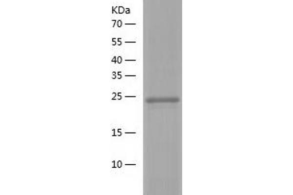 RAB24 Protein (AA 1-227) (His tag)