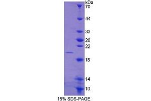 SDS-PAGE (SDS) image for Matrix Metallopeptidase 13 (Collagenase 3) (MMP13) ELISA Kit (ABIN6730928)