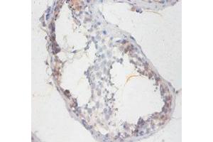 Immunohistochemistry of paraffin-embedded human testis tissue using ABIN7170460 at dilution of 1:100 (SMCP 抗体  (AA 1-116))