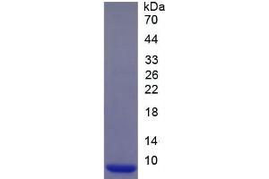 SDS-PAGE of Protein Standard from the Kit (Highly purified E. (CUL9 CLIA Kit)